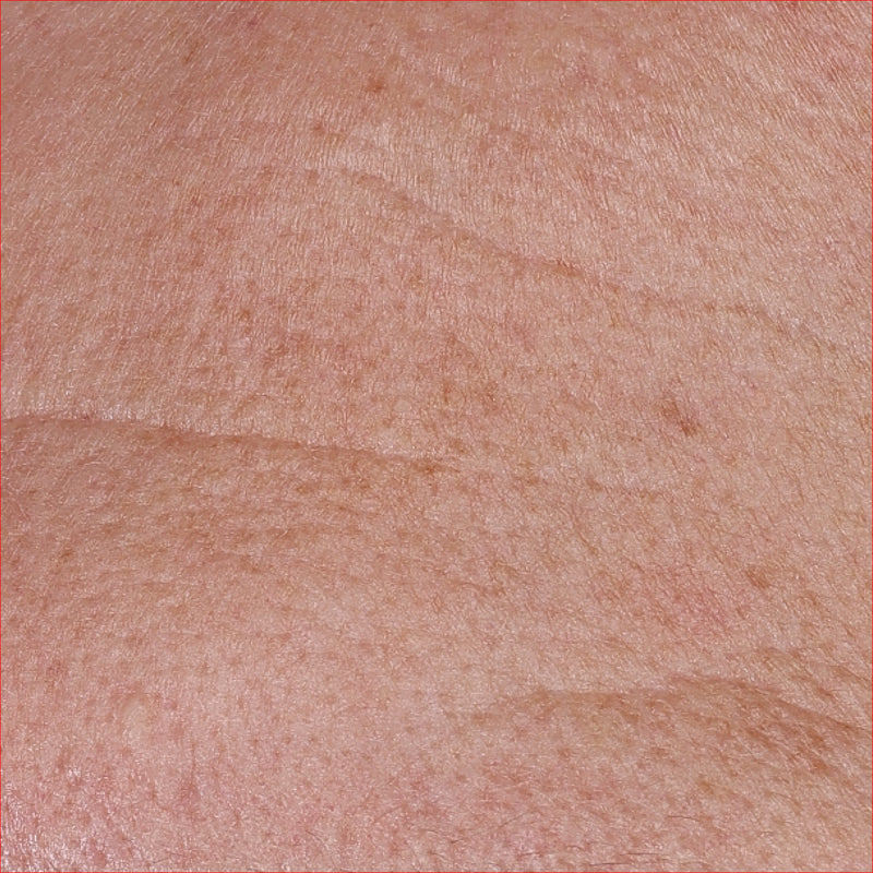 Wrinkles