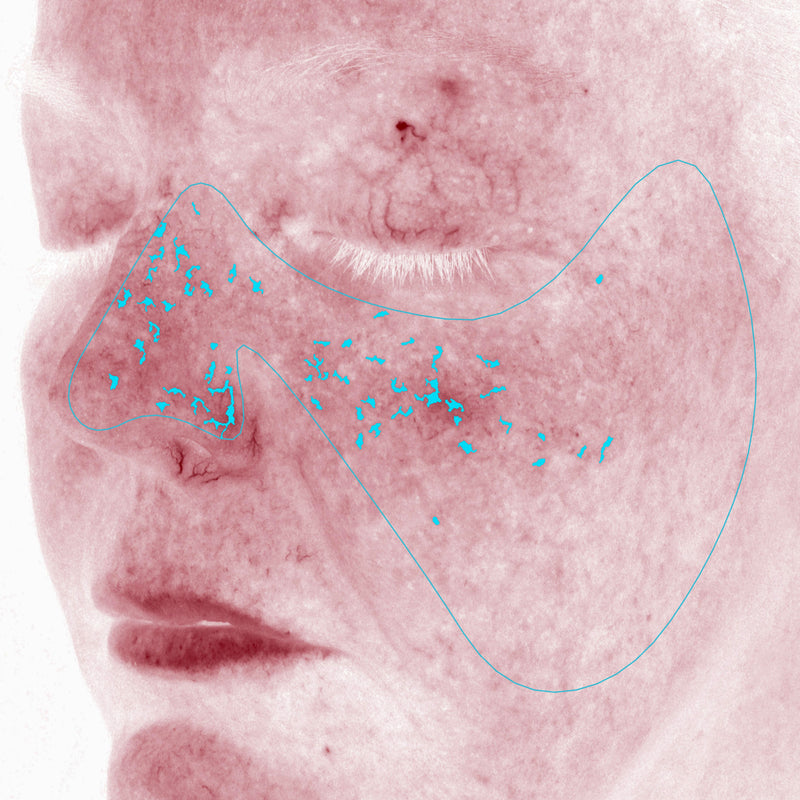Average Redness