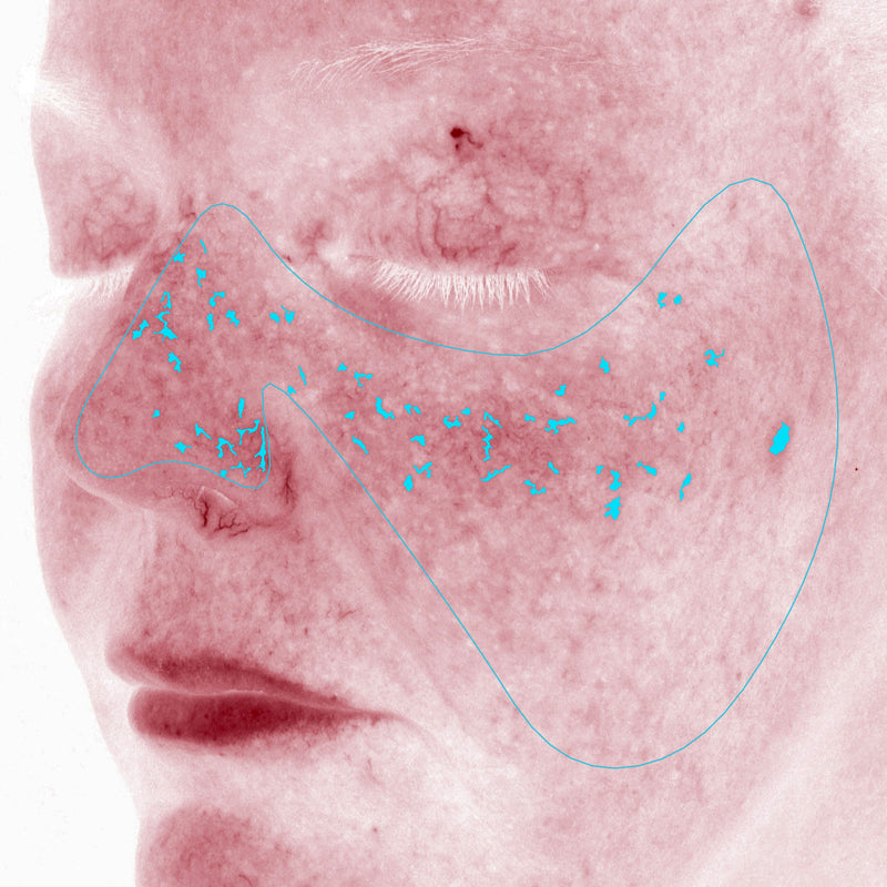 Average Redness