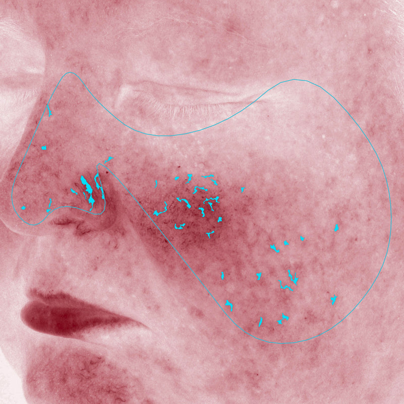Average Redness