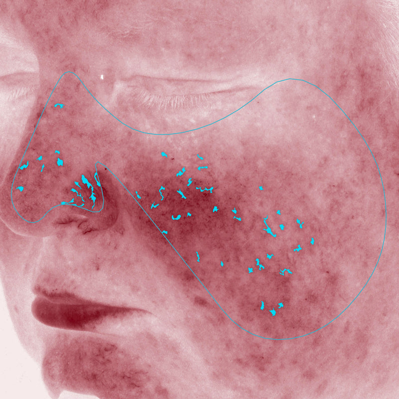 Average Redness